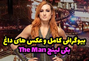 بیوگرافی بکی لینچ THE MAN ستاره زن محبوب WWE + عکس های داغ